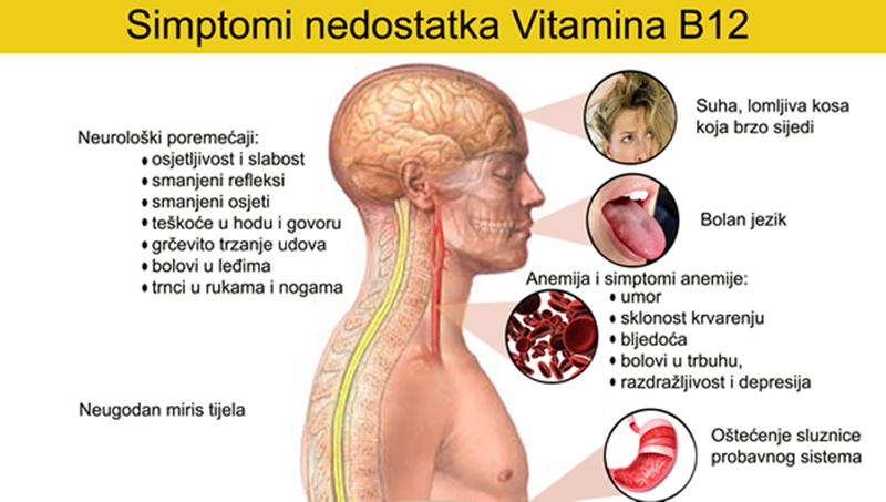 Vitamin-B12