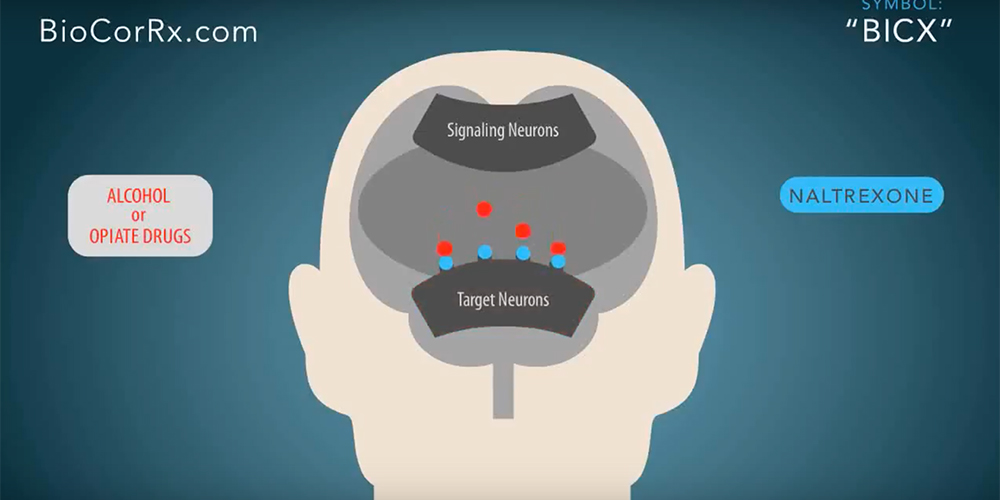 How naltrexone works